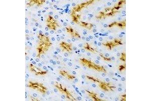 Immunohistochemistry (IHC) image for anti-Receptor-Interacting Serine-threonine Kinase 2 (RIPK2) antibody (ABIN7308278) (RIPK2 抗体)
