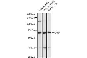 Western blot analysis of extracts of various cell lines, using CMIP antibody (ABIN7265970) at 1:1000 dilution. (CMIP 抗体)