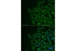 Immunofluorescence analysis of MCF7 cells using LRAT antibody (ABIN6132018, ABIN6143312, ABIN6143315 and ABIN6217189). (LRAT 抗体  (AA 1-194))