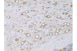 Immunohistochemistry of paraffin-embedded mouse brain using MYH10 antibody. (MYH10 抗体  (AA 1908-2007))