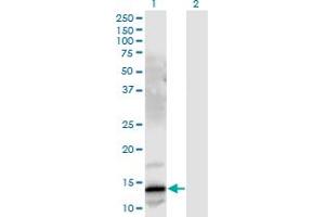 Western Blot analysis of GRP expression in transfected 293T cell line by GRP monoclonal antibody (M03), clone 3A11. (Gastrin-Releasing Peptide 抗体  (AA 1-148))