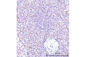 IHC analysis of Nesprin3/SYNE3 using anti-Nesprin3/SYNE3 antibody (ABIN7601328). (Nesprin3 抗体  (AA 322-495))