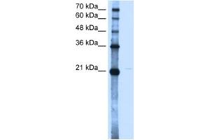 WB Suggested Anti-OLR1 Antibody Titration:  2. (OLR1 抗体  (N-Term))