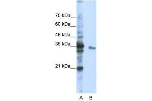 EXOSC3 antibody used at 1 ug/ml to detect target protein. (EXOSC3 抗体  (Middle Region))
