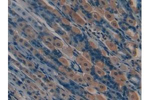 Detection of MMP12 in Mouse Stomach Tissue using Polyclonal Antibody to Matrix Metalloproteinase 12 (MMP12)