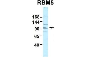 Human HepG2 (RBM5 抗体  (N-Term))