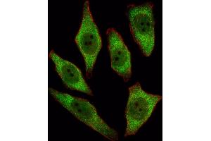 Fluorescent image of A549 cell stained with RT Antibody (N-term) 2893a/SA091009AF.
