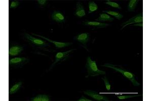 Immunofluorescence of purified MaxPab antibody to PPP2CB on HeLa cell.