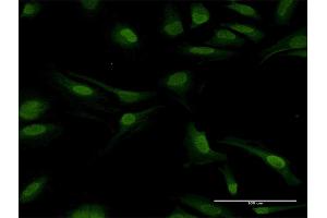 Immunofluorescence of purified MaxPab antibody to PPP2CB on HeLa cell. (PPP2CB 抗体  (AA 1-309))