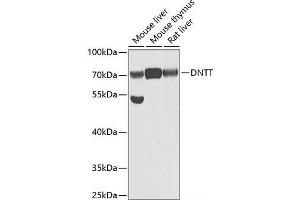 Western blot analysis of extracts of various cell lines using DNTT Polyclonal Antibody at dilution of 1:1000. (TdT 抗体)
