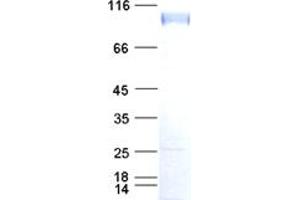 Validation with Western Blot (EGFR Protein (His tag))