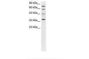 Image no. 3 for anti-Cyclin-Dependent Kinase 7 (CDK7) (C-Term) antibody (ABIN202294) (CDK7 抗体  (C-Term))