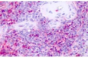 Anti-NR1D1 antibody IHC staining of human spleen. (NR1D1 抗体  (Internal Region))