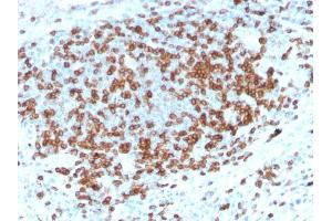 Formalin-fixed, paraffin-embedded human Tonsil stained with CD3e Rabbit Recombinant Monoclonal Antibody (C3e/3125R). (Recombinant CD3 epsilon 抗体  (AA 23-119))