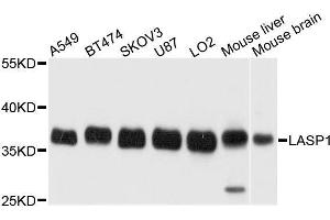 Western blot analysis of extracts of various cell lines, using LASP1 antibody. (LASP1 抗体  (AA 130-205))