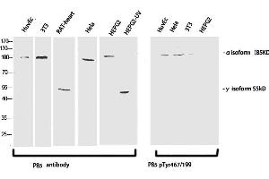 Western Blotting (WB) image for anti-Phosphoinositide 3 Kinase, p85 alpha/gamma (PI3K p85a/g) (pTyr199), (pTyr467) antibody (ABIN5956305) (PI3K p85 alpha/gamma 抗体  (pTyr199, pTyr467))