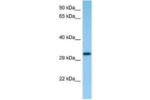 WB Suggested Anti-Capzb Antibody Titration: 1. (CAPZB 抗体  (C-Term))