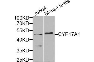 Western blot analysis of extracts of Jurkat and mouse testis cells, using CYP17A1 antibody. (CYP17A1 抗体)