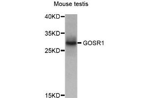 Western blot analysis of extract of various cells, using GOSR1 antibody. (GS28 抗体)