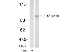 Image no. 1 for anti-Catenin (Cadherin-Associated Protein), beta 1, 88kDa (CTNNB1) (Tyr654) antibody (ABIN319394) (CTNNB1 抗体  (Tyr654))