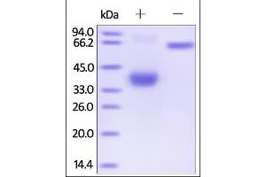 Human BCMA, Fc Tag on SDS-PAGE under reducing (R) and no-reducing (NR) conditions. (BCMA Protein (AA 1-54) (Fc Tag))