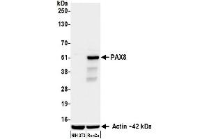 Western Blotting (WB) image for anti-Paired Box 8 (PAX8) (AA 225-275) antibody (ABIN7795777)