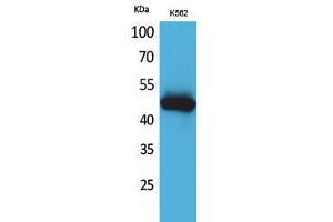 Western Blotting (WB) image for anti-Interleukin 5 Receptor, alpha (IL5RA) (N-Term) antibody (ABIN3187749) (IL5RA 抗体  (N-Term))