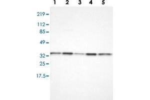 Western blot analysis of Lane 1: RT-4, Lane 2: U-251 MG, Lane 3: A-431, Lane 4: Liver, Lane 5: Tonsil with CYB5R3 polyclonal antibody  at 1:100-1:250 dilution. (CYB5R3 抗体)
