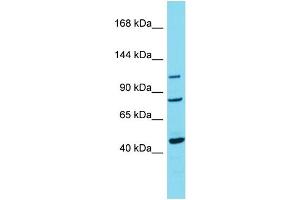 Host:  Rabbit  Target Name:  TRPC7  Sample Type:  Breast Tumor lysates  Antibody Dilution:  1. (TRPC7 抗体  (C-Term))