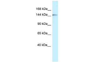 Western Blot showing CLIP1 antibody used at a concentration of 1 ug/ml against Fetal Liver Lysate (CLIP1 抗体  (C-Term))