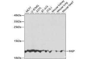 Western blot analysis of extracts of various cell lines using MGP Polyclonal Antibody at dilution of 1:1000.