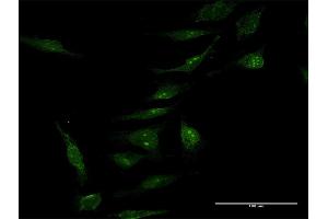 Immunofluorescence of purified MaxPab antibody to MINA on HeLa cell. (MINA 抗体  (AA 1-465))