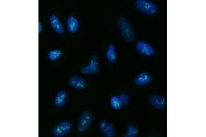 IF analysis of TOX2 using anti-TOX2 antibody (ABIN7601667). (TOX2 抗体  (AA 41-425))