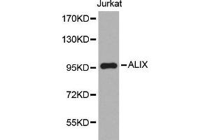 Western blot analysis of extracts of Jurkat cell line, using ALIX antibody. (ALIX 抗体  (AA 1-180))