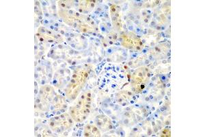 Immunohistochemistry of paraffin-embedded mouse kidney using ADAD1 antibody (ABIN5975411) at dilution of 1/200 (40x lens). (ADAD1 抗体)