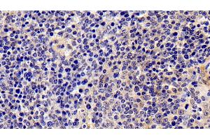 Detection of IL2Ra in Porcine Spleen Tissue using Polyclonal Antibody to Interleukin 2 Receptor Alpha (IL2Ra) (CD25 抗体  (AA 22-245))