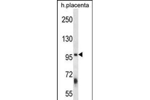 ZFYVE1 Antibody (N-term) (ABIN656392 and ABIN2845686) western blot analysis in human placenta tissue lysates (35 μg/lane).