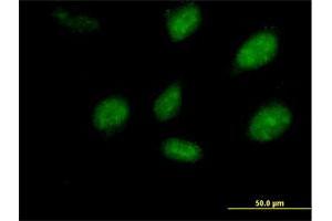 Immunofluorescence of purified MaxPab antibody to PEPP-2 on HeLa cell. (RHOXF2 抗体  (AA 1-288))