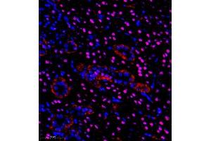 Immunofluorescence of paraffin embedded rat kidney using pax2 (ABIN7074974) at dilution of 1:600 (350x lens) (PAX2A 抗体)