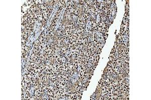IHC analysis of hnRNP L/HNRNPL using anti-hnRNP L/HNRNPL antibody (ABIN7600130).