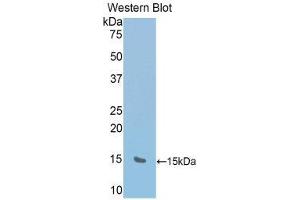 Western Blotting (WB) image for anti-RalA Binding Protein 1 (RALBP1) (AA 527-626) antibody (ABIN1176613) (RALBP1 抗体  (AA 527-626))