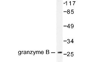 Image no. 1 for anti-Granzyme B (GZMB) antibody (ABIN265445) (GZMB 抗体)