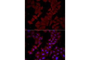 Immunofluorescence analysis of HeLa cells using CCT4 antibody (ABIN5973931). (CCT4 抗体)