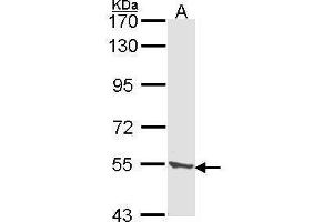 WB Image Sample (30 ug of whole cell lysate) A: A431 , 7. (TPP1 抗体)