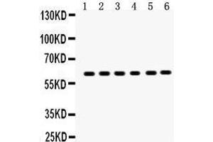 Anti-EAAT2 antibody, Western blotting All lanes: Anti EAAT2  at 0. (SLC1A2 抗体  (AA 461-574))