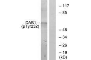 Western Blotting (WB) image for anti-Disabled Homolog 1 (Drosophila) (DAB1) (pTyr232) antibody (ABIN2888392) (DAB1 抗体  (pTyr232))