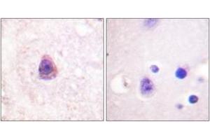 Immunohistochemistry analysis of paraffin-embedded human brain tissue, using Arrestin 1 (Ab-412) Antibody. (SAG 抗体  (AA 369-418))