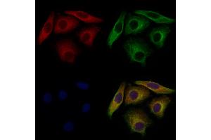 ABIN7094746 and ABIN7098797 staining Hela cells by IF/ICC. (VPS29 抗体  (N-Term))