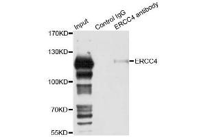 Immunoprecipitation analysis of 150ug extracts of 293T cells using 3ug ERCC4 antibody. (ERCC4 抗体  (AA 600-700))