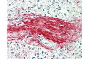 Human Spleen, Trabecula: Formalin-Fixed, Paraffin-Embedded (FFPE).